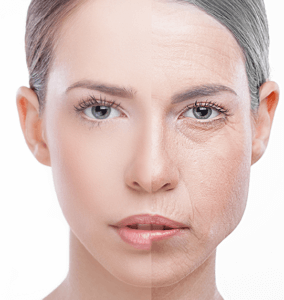 How Does Facelift Surgery Work